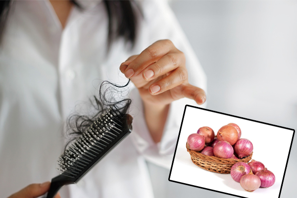 Hair Care Tips: अब टूटते बालों पर लगेगा फुल स्टॉप, इस्तेमाल करें प्याज का तेल