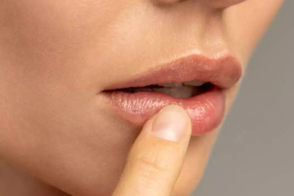 Lips Care Tips: सर्दियों में होठों पर जम गई है पपड़ी, तो करें ये काम